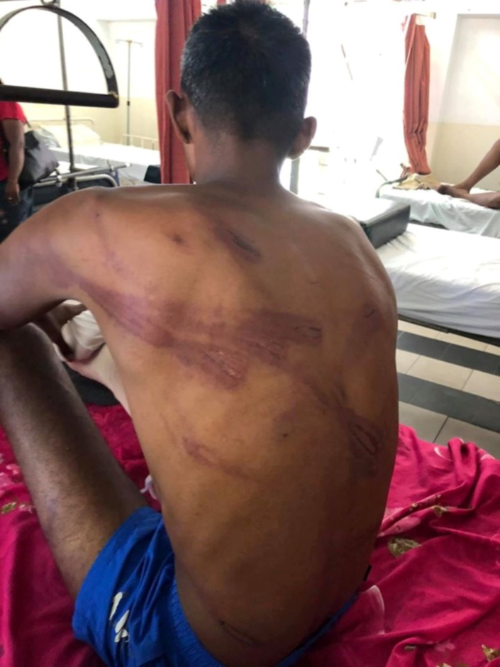 Brutalité policière alléguée : Arrêté pour agression, il réclame Rs 90 millions à l’Etat et au commissaire de police