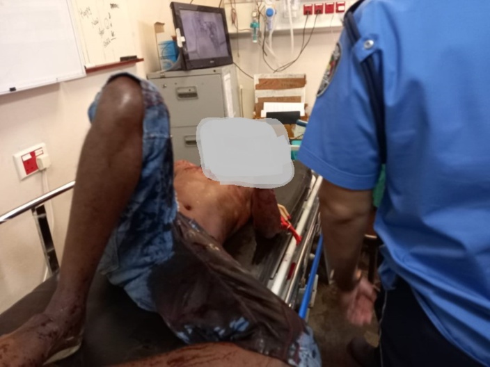 Violente agression à La Tour Koenig : Un homme a le poignet sectionné