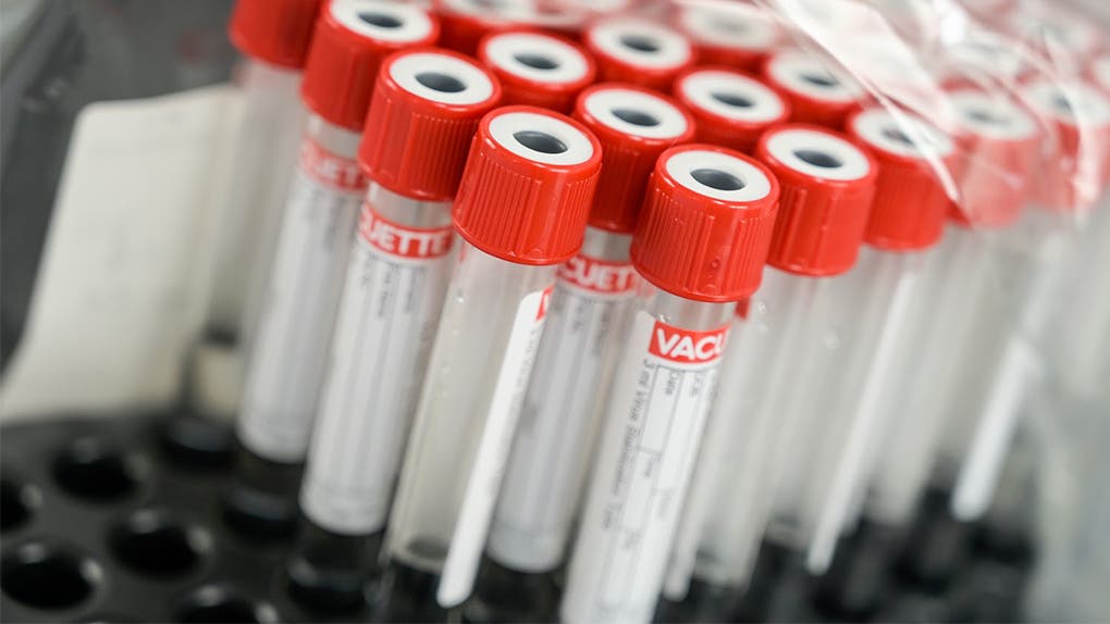 Covid-19 : 11 nouveaux cas enregistrés sur 814 tests PCR
