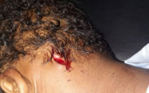 Violence en milieu scolaire : Un enfant de 7 ans se fait agressé avec un couteau