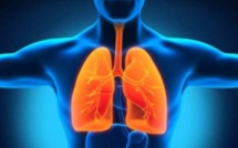 5 507 cas d’infections respiratoires recensées en une semaine