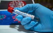 Covid-19 : Le pays compte 335 cas à ce jour, avec trois cas actifs de coronavirus