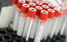 Covid-19 : 11 nouveaux cas enregistrés sur 814 tests PCR