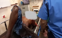 Violente agression à La Tour Koenig : Un homme a le poignet sectionné
